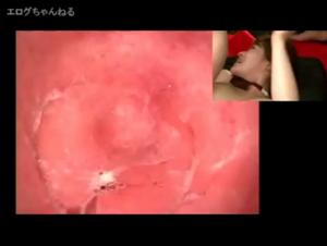 Live Fish Insertion: A Daring Experience