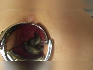 Shocking video: Anal penetration with a speculum