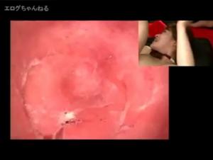 Bitch Fucked by Dog: Extreme Endoscopy Anal Sex