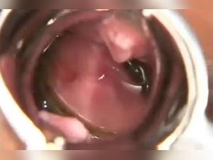 Small fish in privacy: an experience of extreme zoophilia