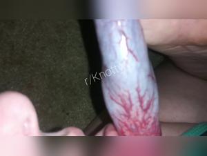 Woman and dog: a story of bestiality