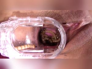 Extreme Bestiality: A Forbidden Encounter between a Dog and Worms